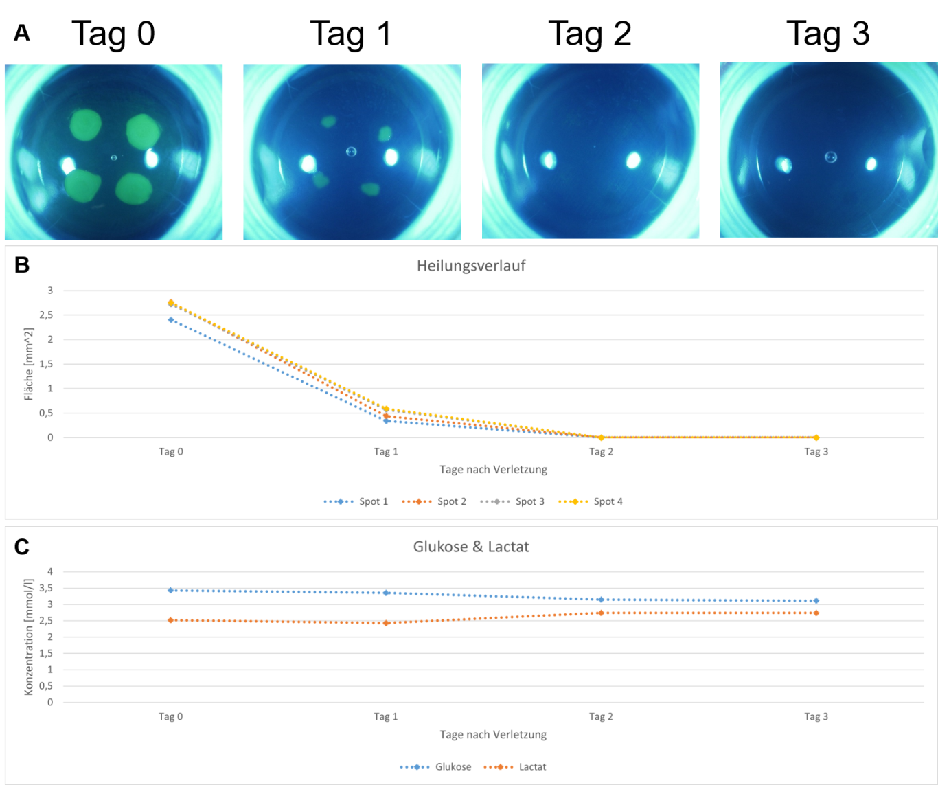 Darstellung der Heilung von 4 Läsionen auf einer Kaninchencornea in einer EVEIT Kammer. Die Cornea ist nach nach Tagen vollständig ausgeheilt. Die Läsionen sind mit Fluoresizin eingefärbt und unter blauem Licht gelbgrün sichtbar. (Weiße Punkte sind Reflexionen der Lichtquelle) Die Fläche der gemessenen Läsionen ist über die Tage im Heilungsverlauf abgebildet. Die gemessenen Glukose und Lactatwerte um die Vitalität der Cornea zu zeigen, sind im zweiten Diagramm dargestellt und zeigen einen normalen Metabolismus der Cornea während der Heilung.